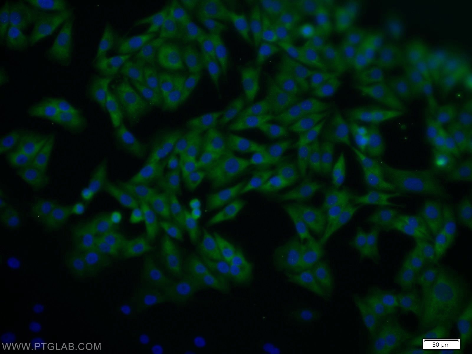 Immunofluorescence (IF) / fluorescent staining of A375 cells using CRBN Polyclonal antibody (11435-1-AP)