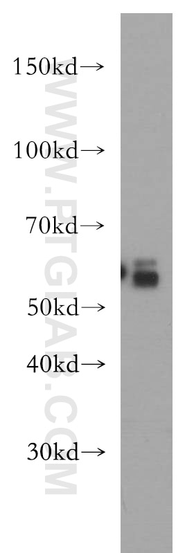 Western Blot (WB) analysis of COLO 320 cells using CRBN Polyclonal antibody (11435-1-AP)