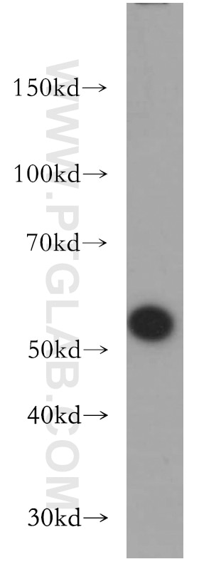 Western Blot (WB) analysis of mouse heart tissue using CRBN Polyclonal antibody (11435-1-AP)