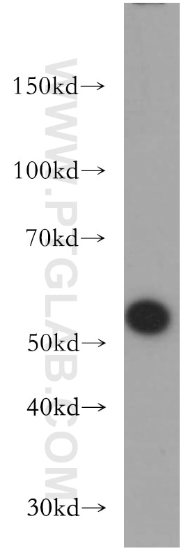 WB analysis of mouse heart using 11435-1-AP