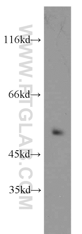 Western Blot (WB) analysis of human brain tissue using CRBN Polyclonal antibody (11435-1-AP)