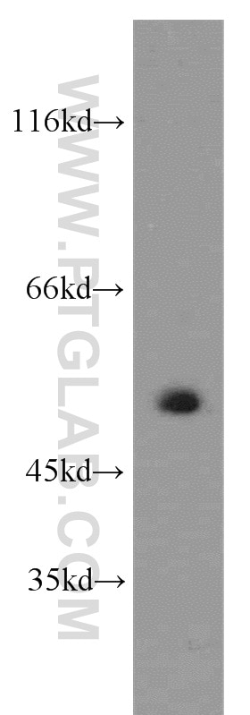 Western Blot (WB) analysis of human brain tissue using CRBN Polyclonal antibody (11435-1-AP)