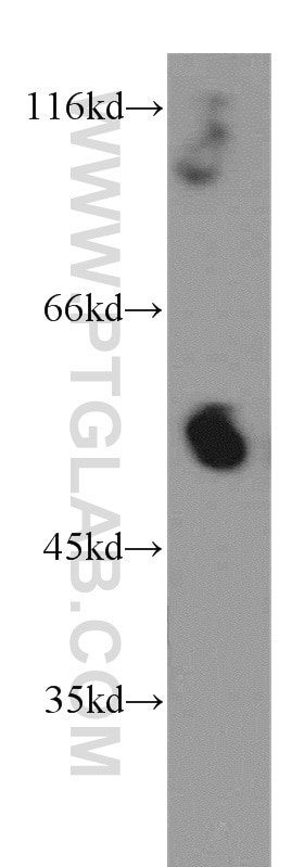 Western Blot (WB) analysis of A375 cells using CRBN Polyclonal antibody (11435-1-AP)
