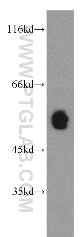 Western Blot (WB) analysis of A375 cells using CRBN Polyclonal antibody (11435-1-AP)