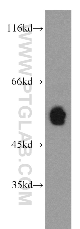 WB analysis of A375 using 11435-1-AP