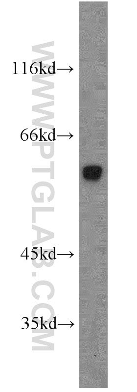 Western Blot (WB) analysis of mouse liver tissue using CRBN Polyclonal antibody (11435-1-AP)