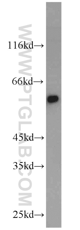 Western Blot (WB) analysis of mouse heart tissue using CRBN Polyclonal antibody (11435-1-AP)