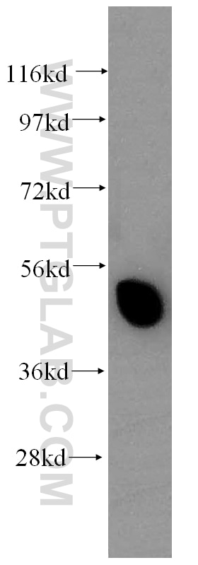 Western Blot (WB) analysis of human heart tissue using CRBN Polyclonal antibody (11435-1-AP)