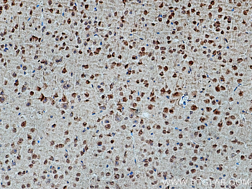 Immunohistochemistry (IHC) staining of mouse brain tissue using CRBN Polyclonal antibody (28494-1-AP)