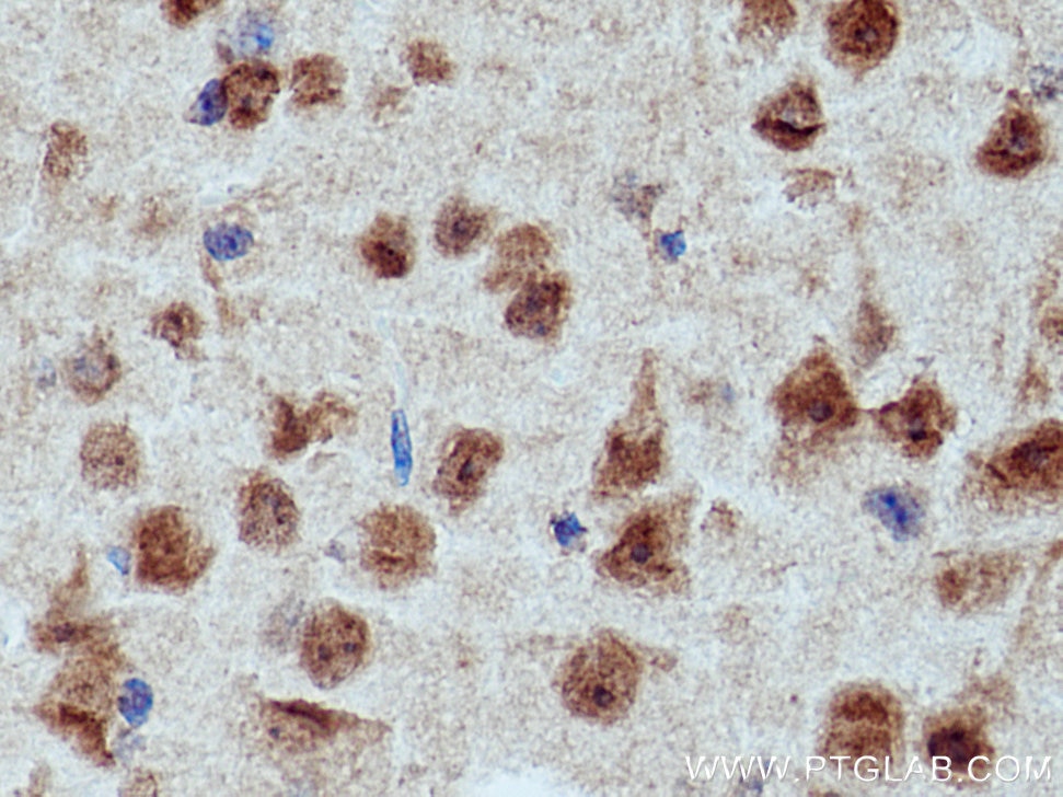 Immunohistochemistry (IHC) staining of mouse brain tissue using CRBN Polyclonal antibody (28494-1-AP)