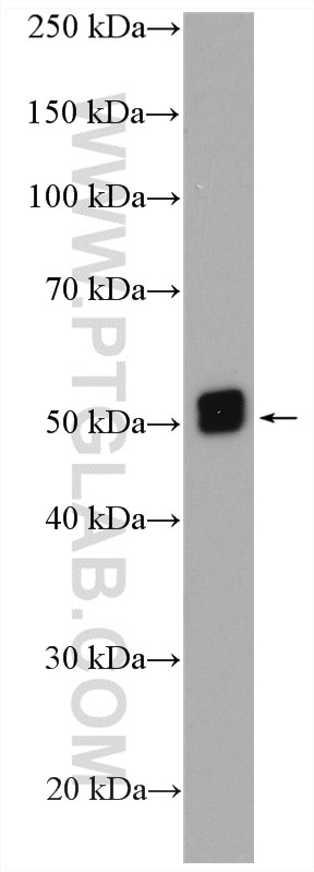 Western Blot (WB) analysis of mouse liver tissue using CRBN Polyclonal antibody (28494-1-AP)