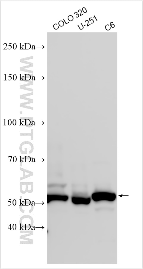 Western Blot (WB) analysis of various lysates using CRBN Polyclonal antibody (28494-1-AP)