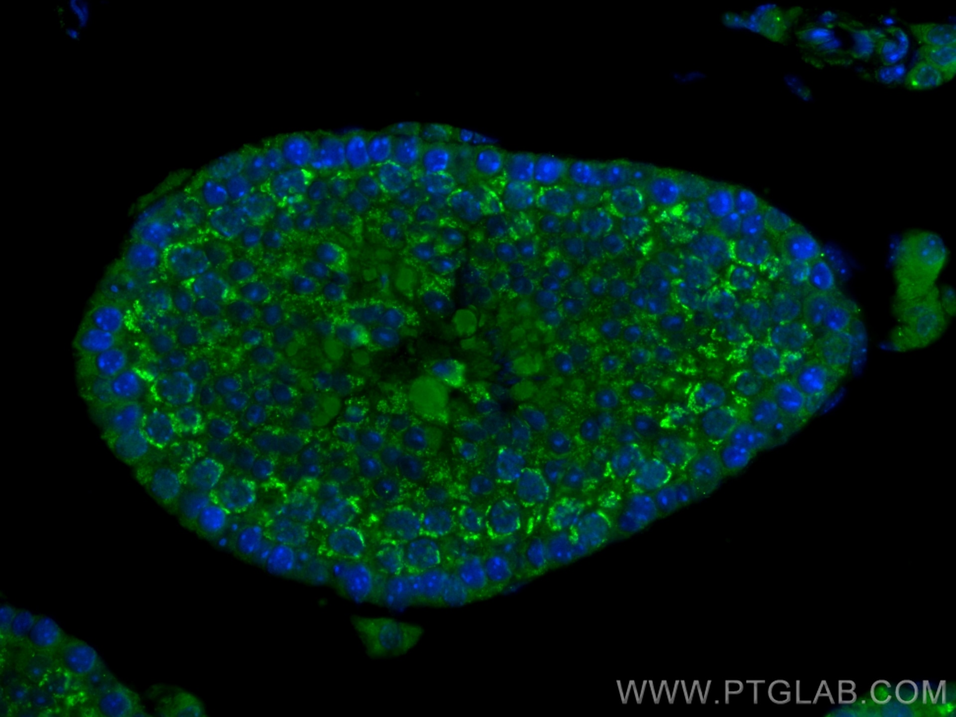 Immunofluorescence (IF) / fluorescent staining of mouse testis tissue using CRCP Polyclonal antibody (14348-1-AP)