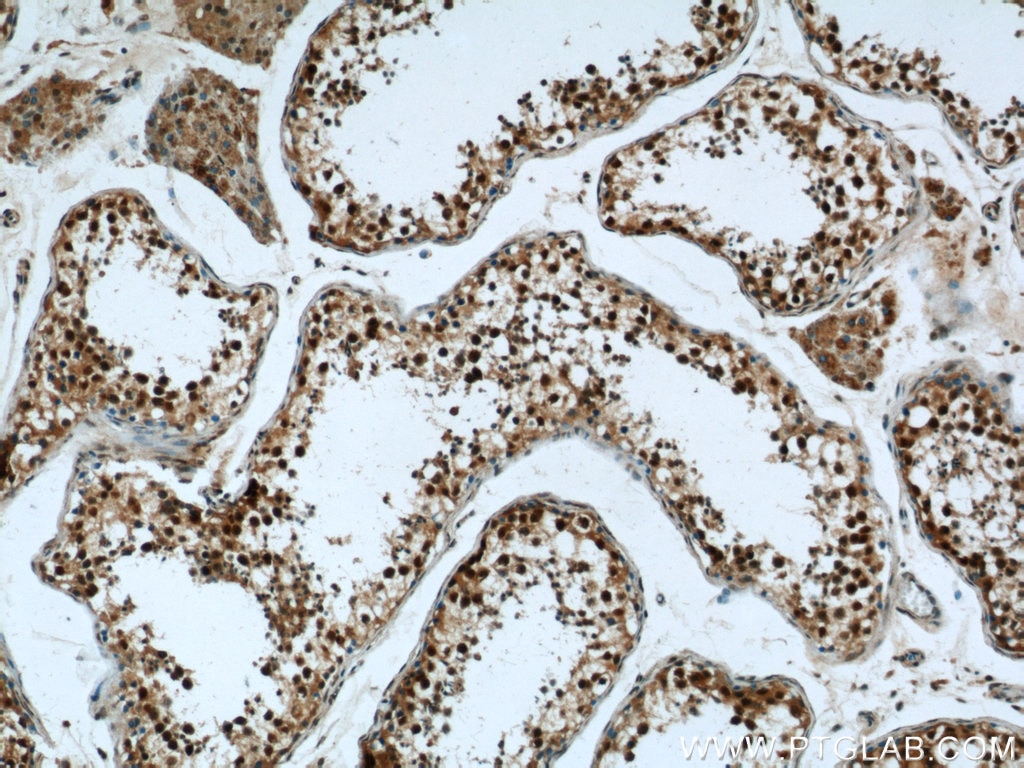 Immunohistochemistry (IHC) staining of human testis tissue using CRCP Polyclonal antibody (14348-1-AP)