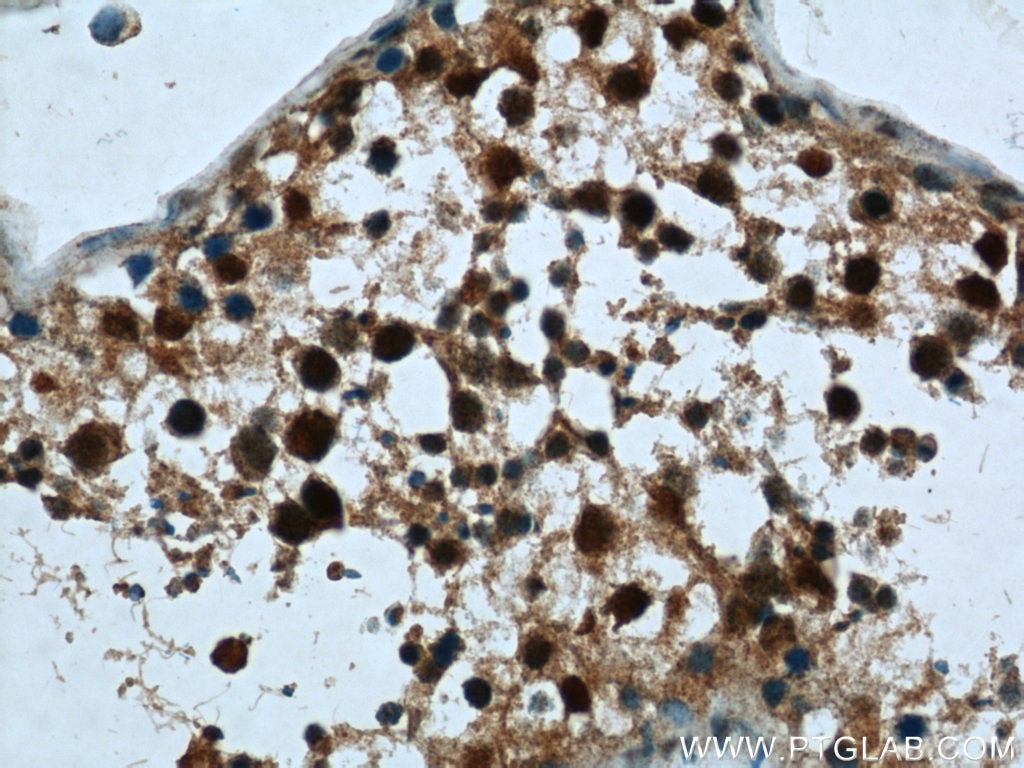 Immunohistochemistry (IHC) staining of human testis tissue using CRCP Polyclonal antibody (14348-1-AP)