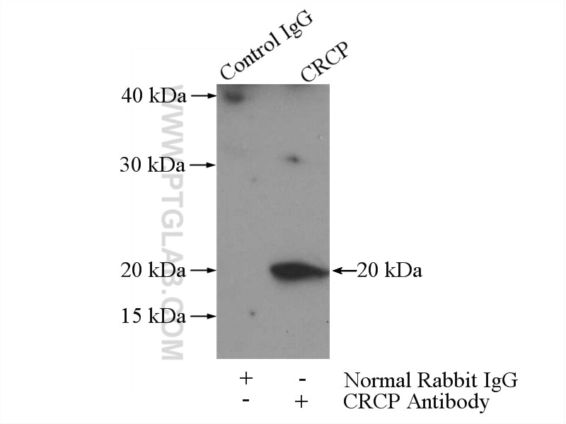 Immunoprecipitation (IP) experiment of Raji cells using CRCP Polyclonal antibody (14348-1-AP)