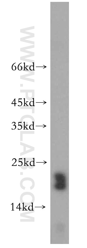 Western Blot (WB) analysis of human testis tissue using CRCP Polyclonal antibody (14348-1-AP)