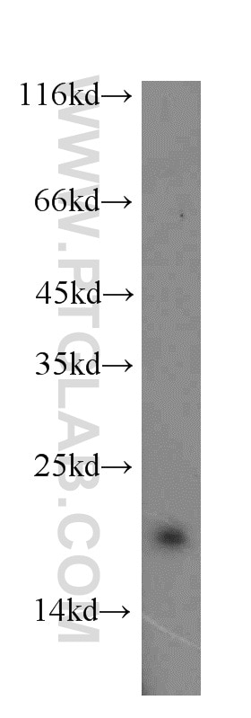 WB analysis of HeLa using 14348-1-AP