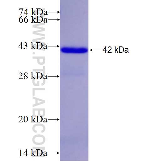CRCP fusion protein Ag5689 SDS-PAGE