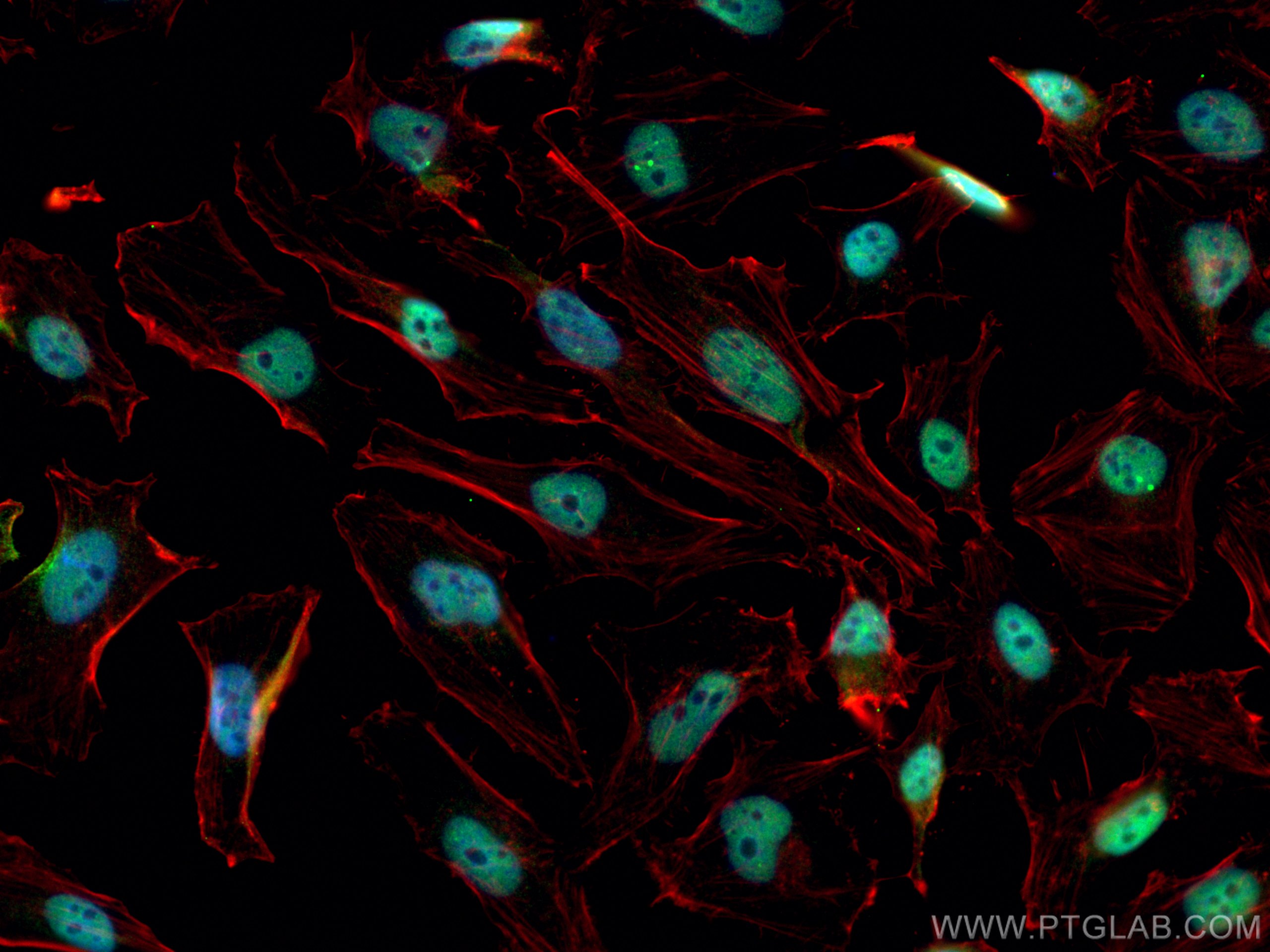 Immunofluorescence (IF) / fluorescent staining of HeLa cells using CREB1 Polyclonal antibody (12208-1-AP)