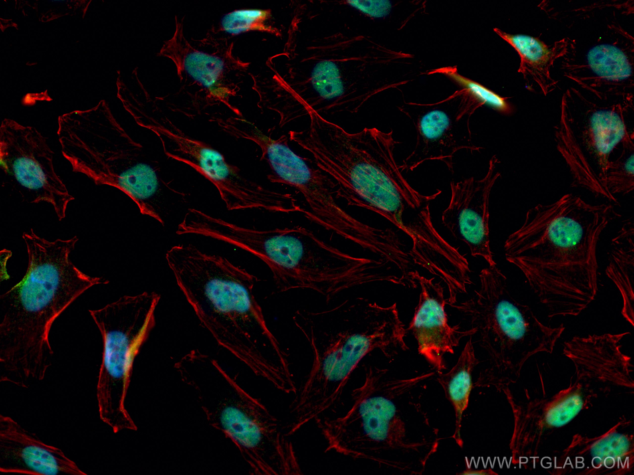 IF Staining of HeLa using 12208-1-AP