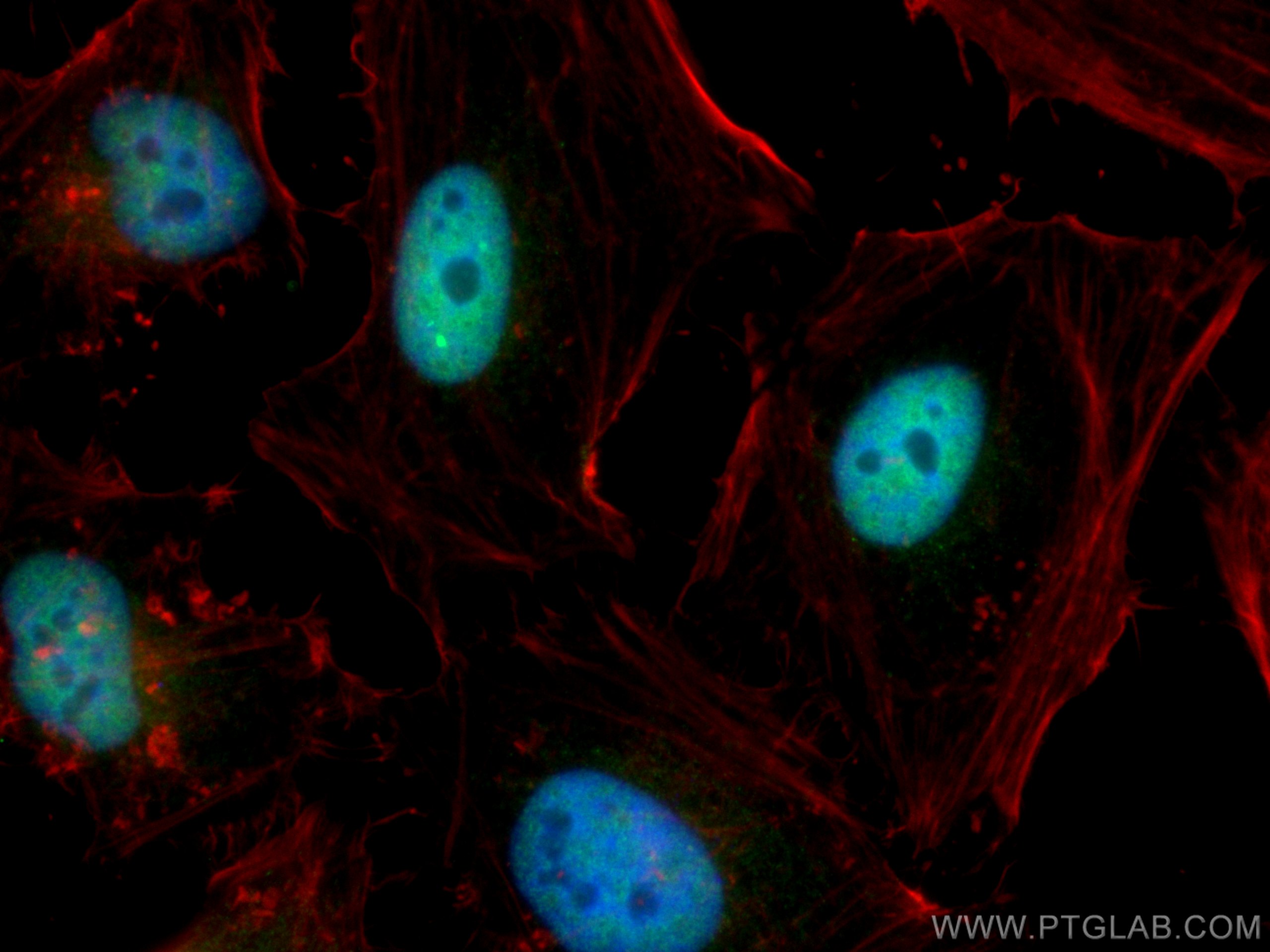 Immunofluorescence (IF) / fluorescent staining of HeLa cells using CREB1 Polyclonal antibody (12208-1-AP)