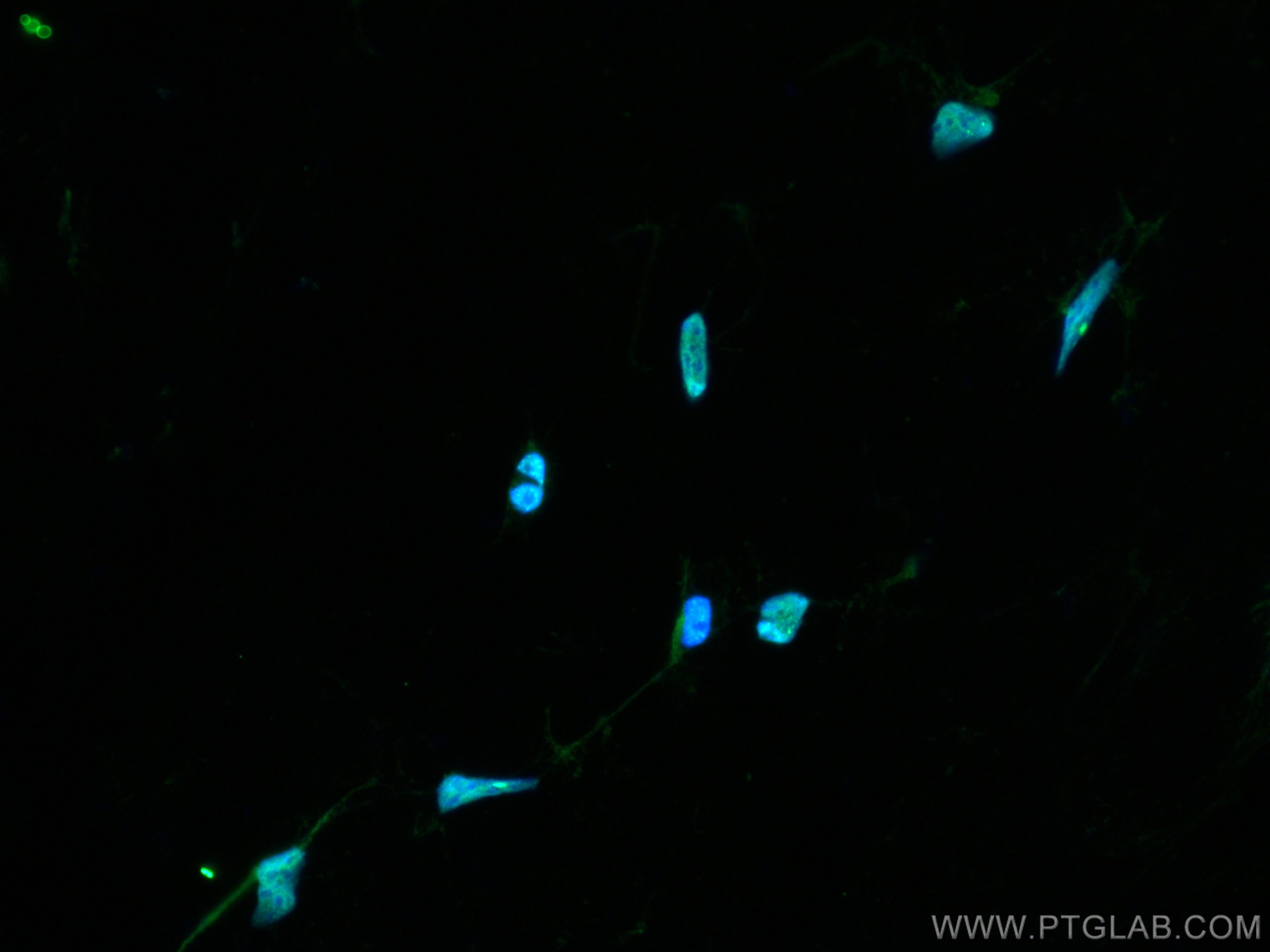 Immunofluorescence (IF) / fluorescent staining of HEK-293 cells using CREB1 Polyclonal antibody (12208-1-AP)