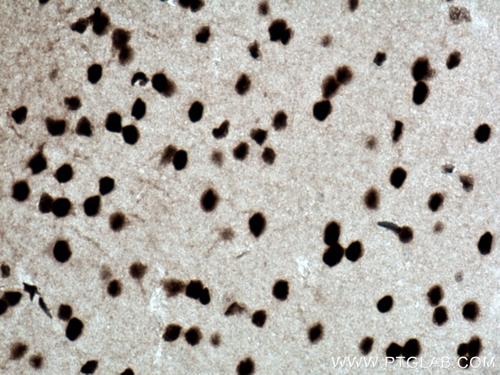 Immunohistochemistry (IHC) staining of mouse brain tissue using CREB1 Polyclonal antibody (12208-1-AP)