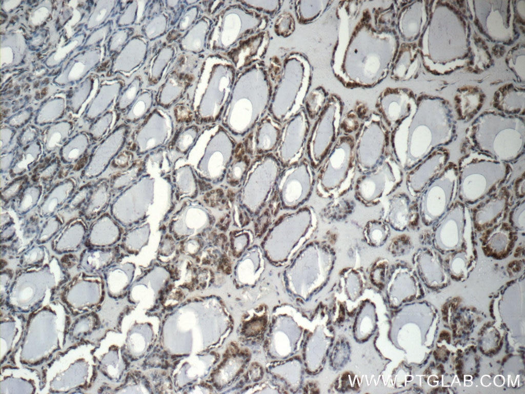 Immunohistochemistry (IHC) staining of human thyroid tissue using CREB1 Polyclonal antibody (12208-1-AP)