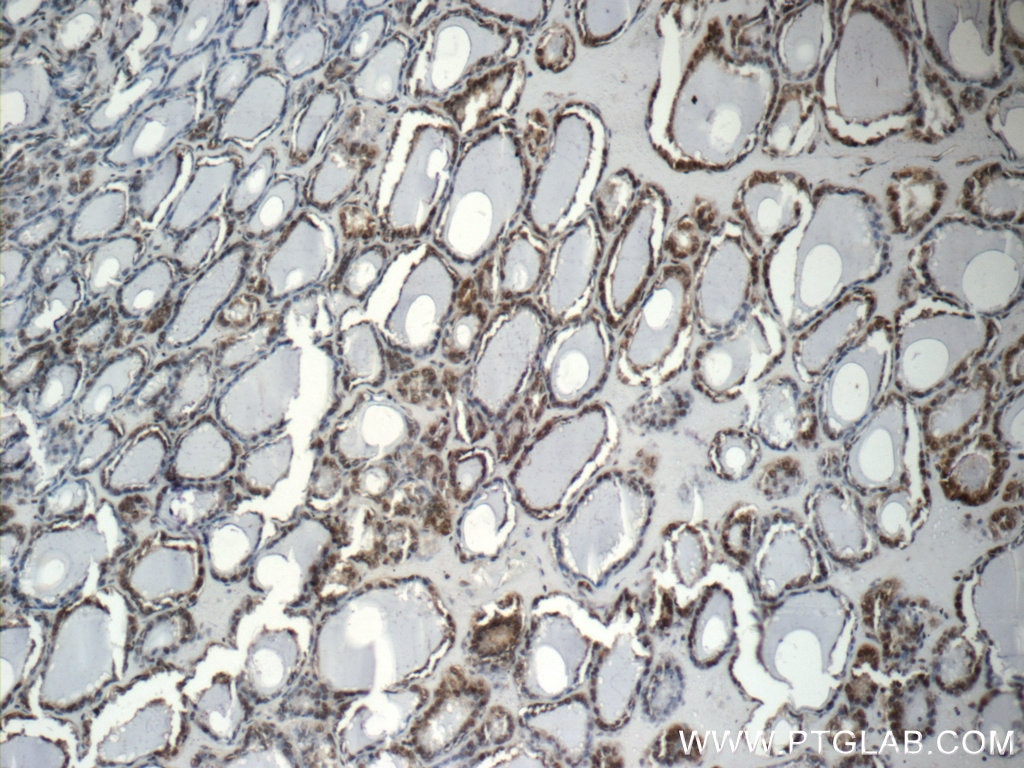 IHC staining of human thyroid using 12208-1-AP