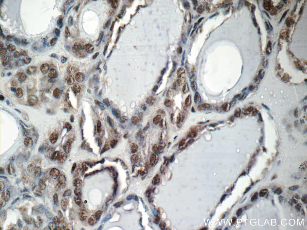 IHC staining of human thyroid using 12208-1-AP