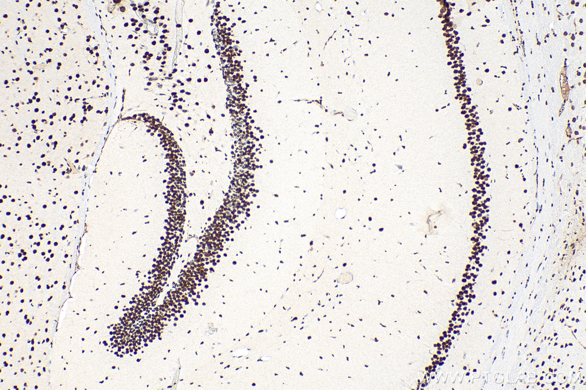 Immunohistochemistry (IHC) staining of mouse brain tissue using CREB1 Polyclonal antibody (12208-1-AP)