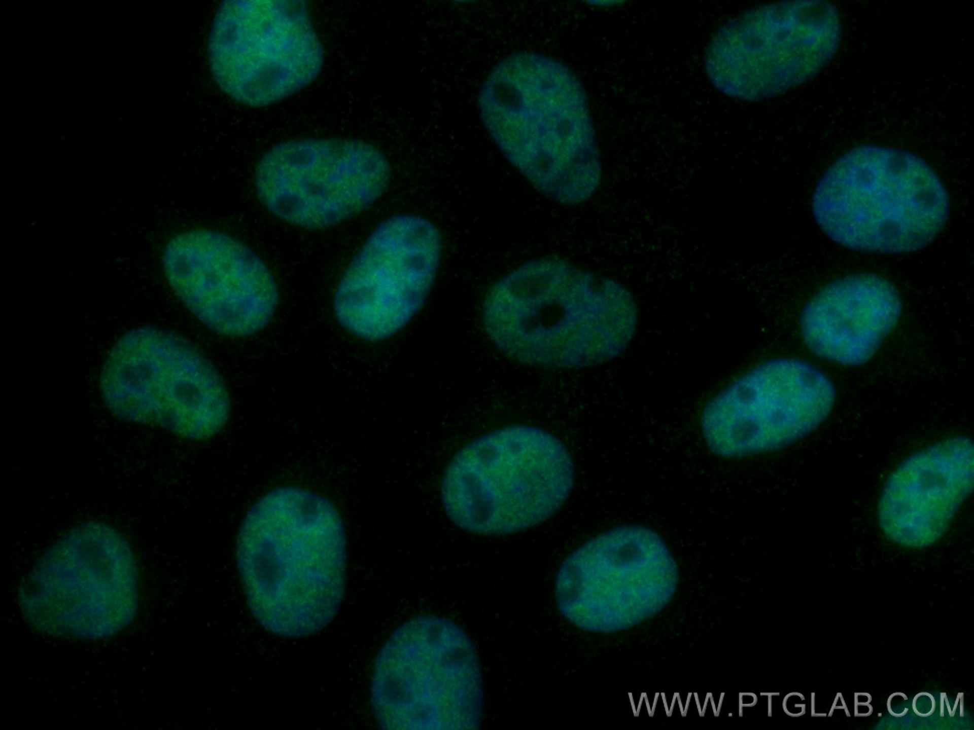 Immunofluorescence (IF) / fluorescent staining of A431 cells using CREB1 Monoclonal antibody (67927-1-Ig)