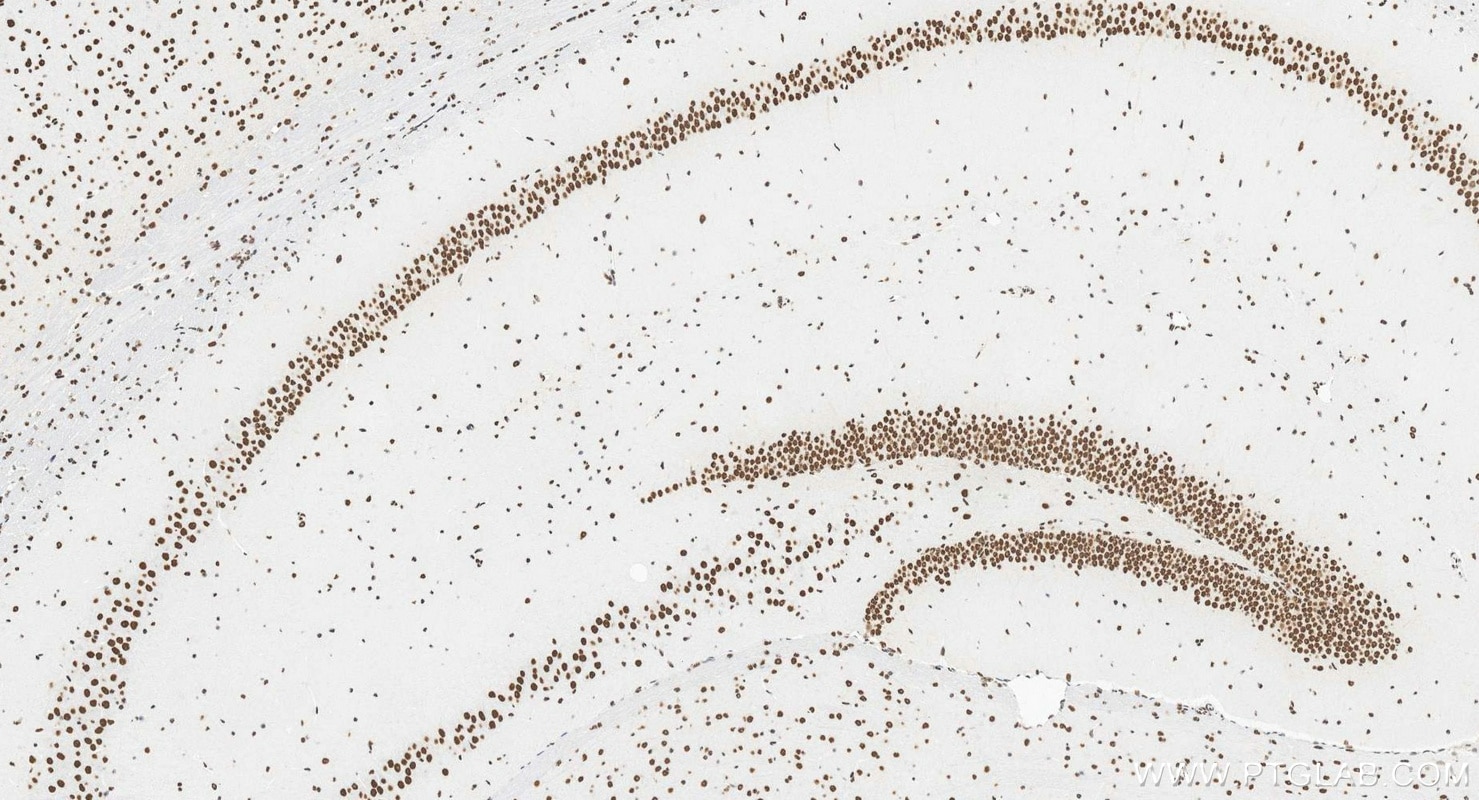 Immunohistochemistry (IHC) staining of mouse brain tissue using CREB1 Recombinant monoclonal antibody (88035-1-RR)