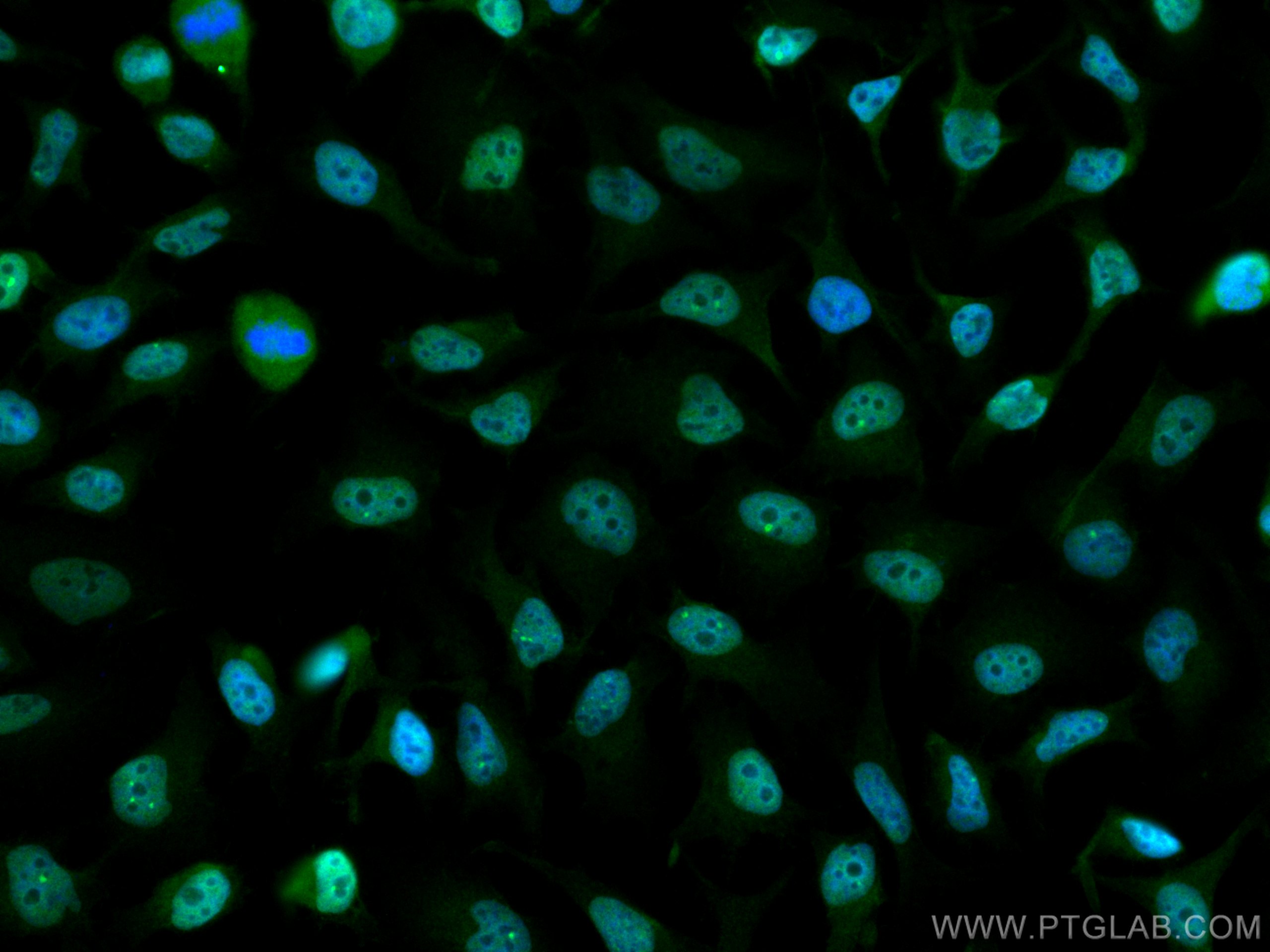 IF Staining of HeLa using CL488-12208