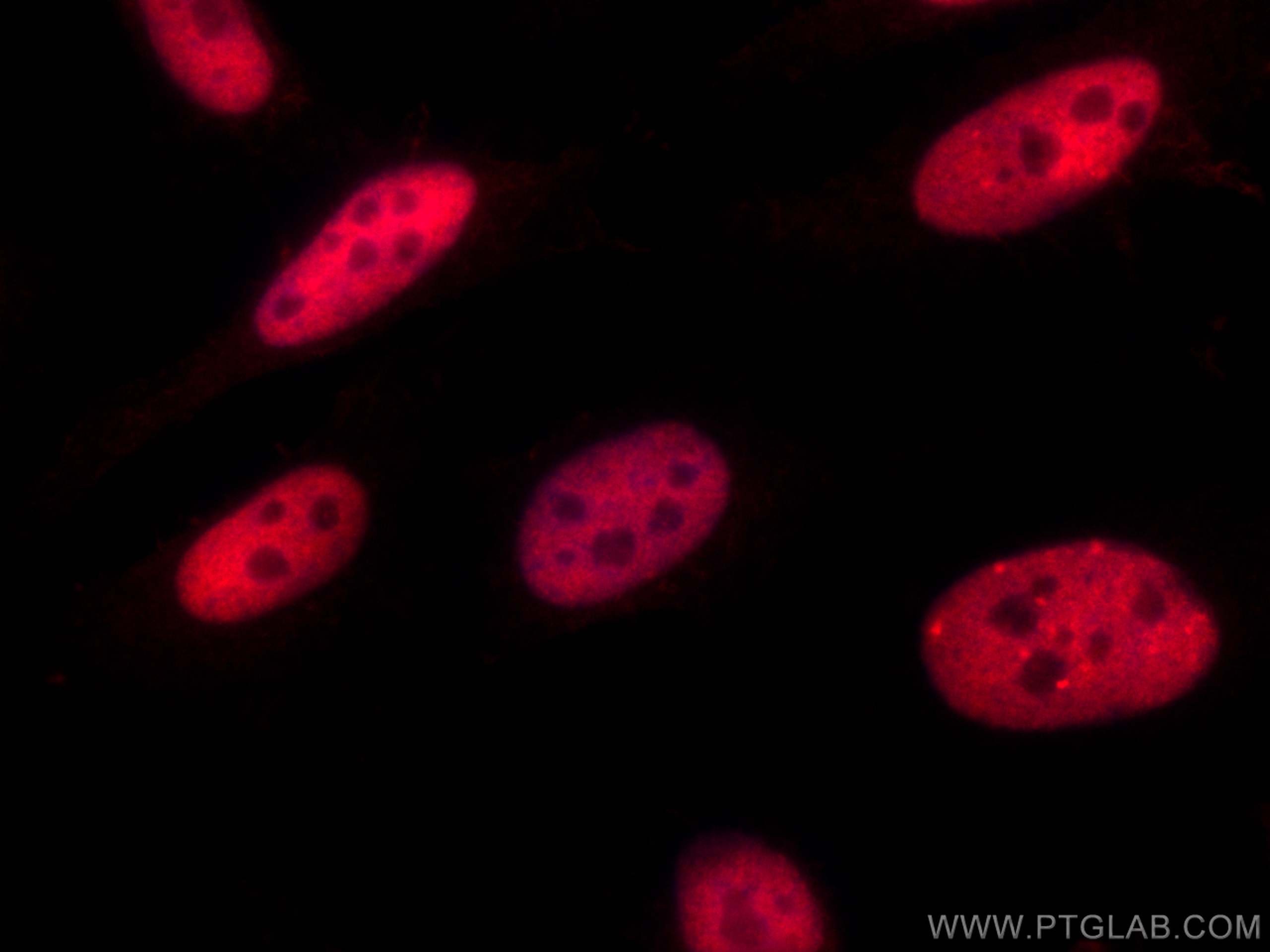 Immunofluorescence (IF) / fluorescent staining of HeLa cells using CoraLite®594-conjugated CREB1 Polyclonal antibody (CL594-12208)