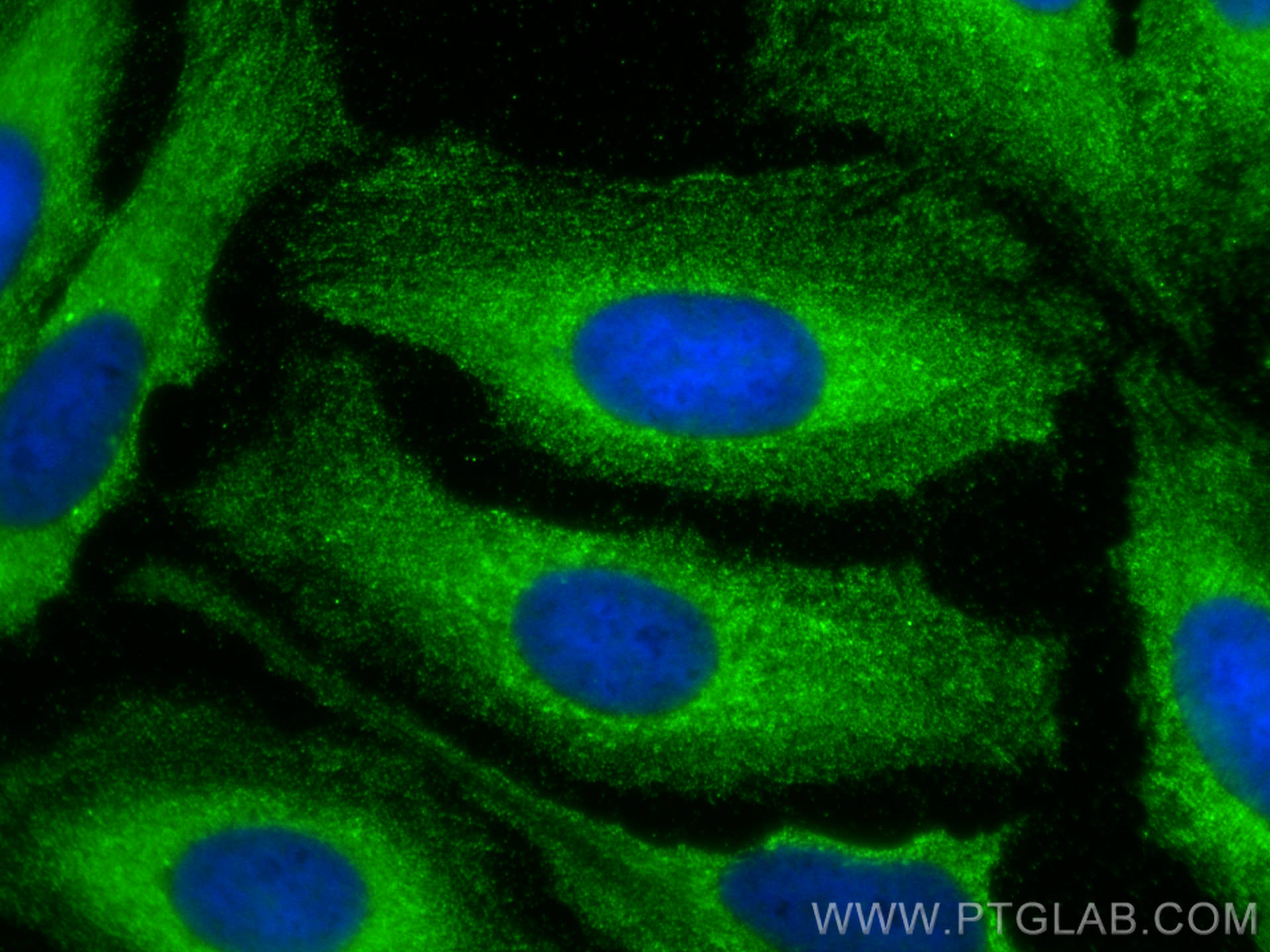 Immunofluorescence (IF) / fluorescent staining of U2OS cells using CREB3 Polyclonal antibody (11275-1-AP)