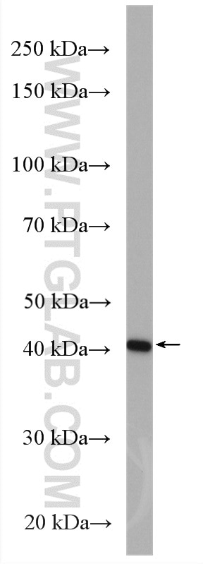 Western Blot (WB) analysis of Jurkat cells using CREB3 Polyclonal antibody (11275-1-AP)
