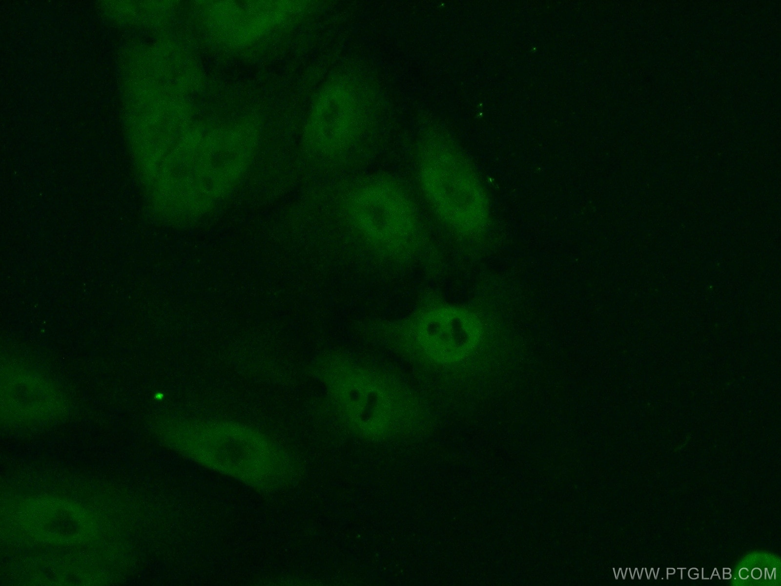 Immunofluorescence (IF) / fluorescent staining of A549 cells using CREB3L1,OASIS Polyclonal antibody (11235-2-AP)