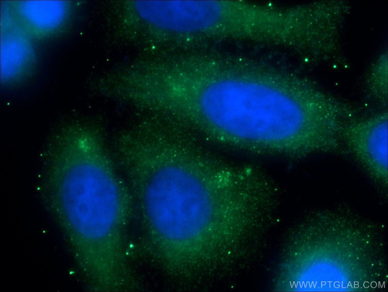 Immunofluorescence (IF) / fluorescent staining of HepG2 cells using CREB3L2 Polyclonal antibody (14514-1-AP)