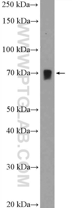 Western Blot (WB) analysis of mouse liver tissue using CREB3L2 Polyclonal antibody (14514-1-AP)