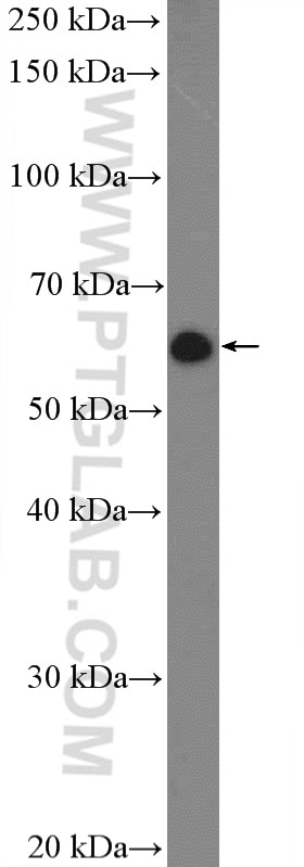 Western Blot (WB) analysis of HepG2 cells using CREB3L2 Polyclonal antibody (14514-1-AP)