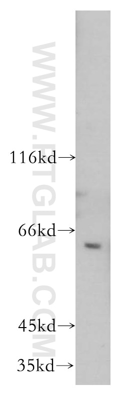 Western Blot (WB) analysis of mouse testis tissue using CREB3L2 Polyclonal antibody (14514-1-AP)