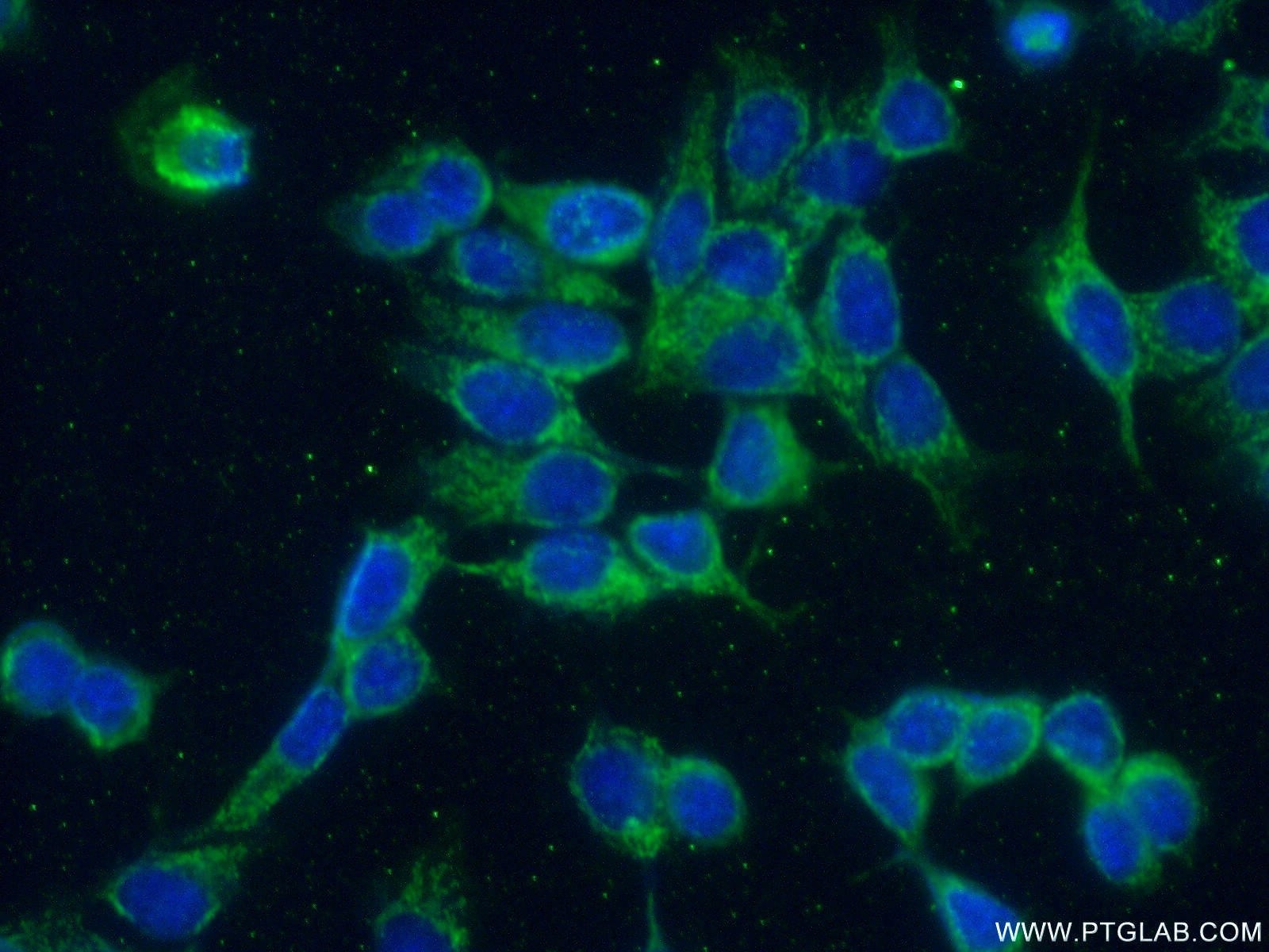 Immunofluorescence (IF) / fluorescent staining of MCF-7 cells using CREB3L4 Polyclonal antibody (13630-1-AP)