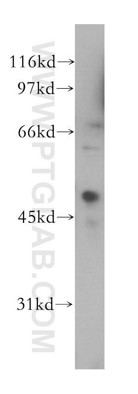 Western Blot (WB) analysis of HL-60 cells using CREB3L4 Polyclonal antibody (13630-1-AP)