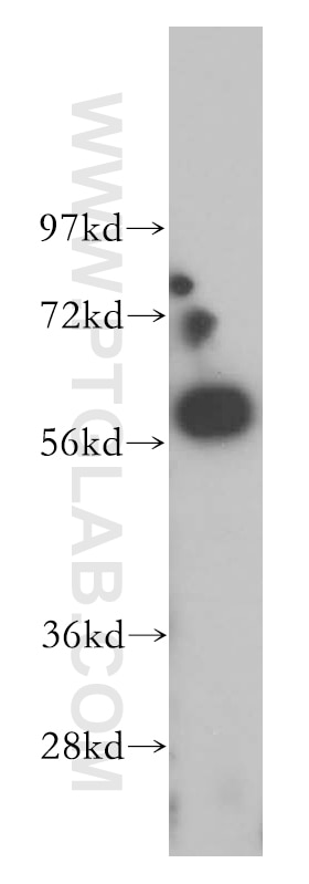 Western Blot (WB) analysis of human brain tissue using CREB5 Polyclonal antibody (14196-1-AP)
