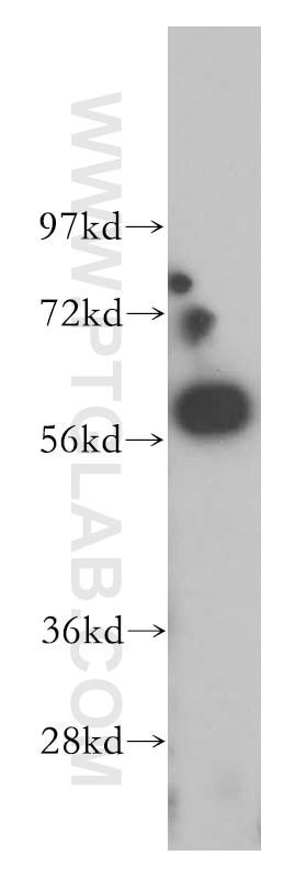 WB analysis of human brain using 14196-1-AP