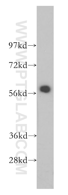 Western Blot (WB) analysis of HepG2 cells using CREB5 Polyclonal antibody (14196-1-AP)