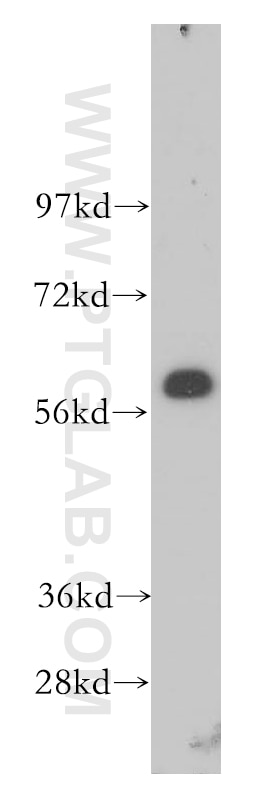 Western Blot (WB) analysis of HeLa cells using CREB5 Polyclonal antibody (14196-1-AP)