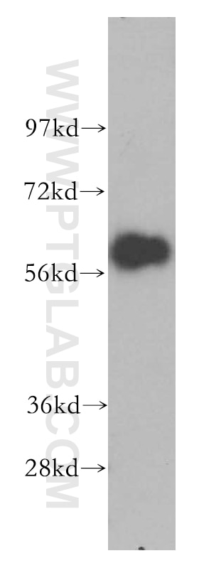 Western Blot (WB) analysis of MCF-7 cells using CREB5 Polyclonal antibody (14196-1-AP)